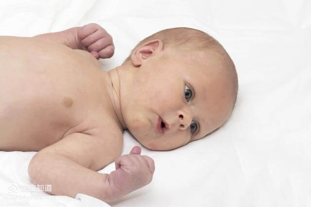 寶寶黃疸不高真的沒有關係嗎？ 不妨關注這個病例，可以預防接種嗎-2